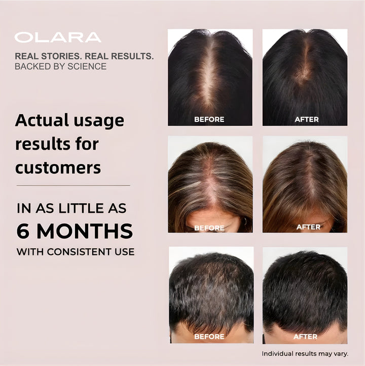 Olara LED Cap for Hair & Scalp Wellness - Red Light Therapy