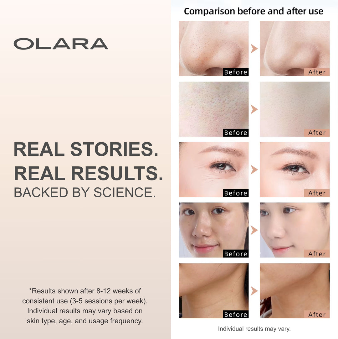 Olara 8-Color LED Face & Neck Mask — Anti-Aging Red Light Therapy 